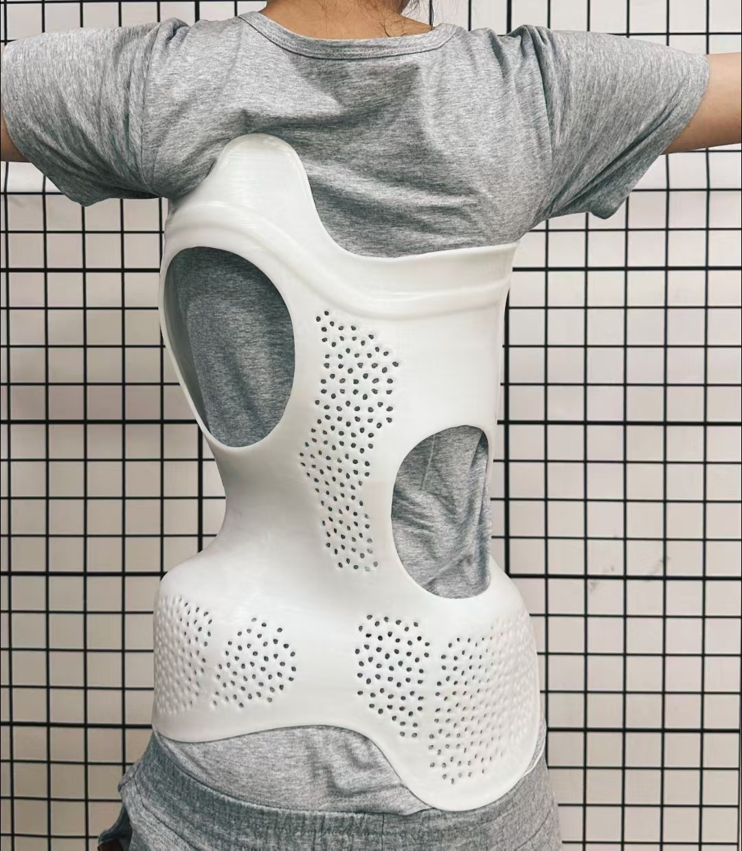 脊柱側(cè)彎支具穿戴3個(gè)月要及時(shí)復(fù)查